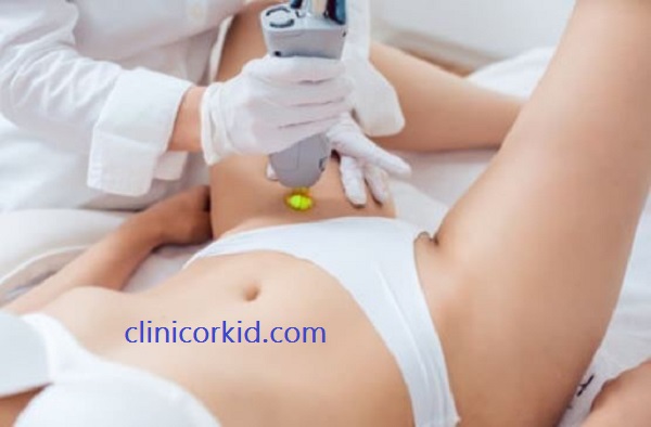 لیزر بیکینی شامل کجا است؟ - کلینیک ارکید