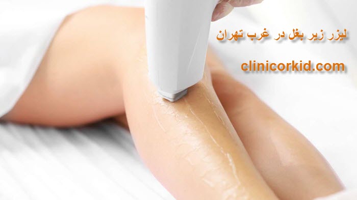 لیزر زیر بغل در غرب تهران - کلینیک ارکید