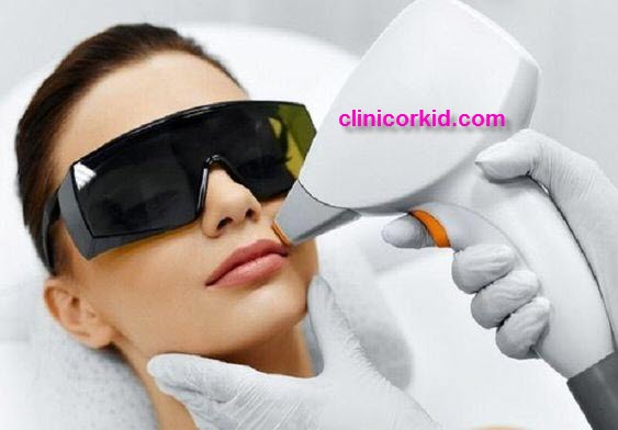 تخفیف لیزر کل بدن - کلینیک ارکید