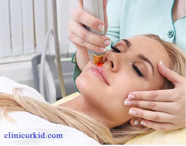 لیزر موهای صورت در غرب تهران - کلینیک ارکید