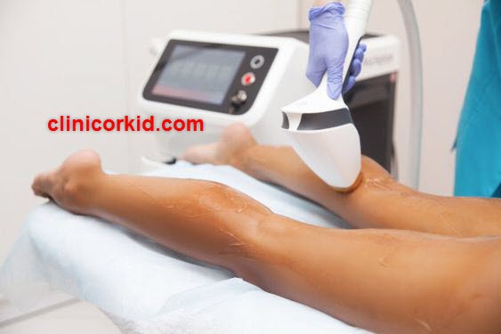 فواید و مزایای لیزر موهای بدن - کلینیک ارکید