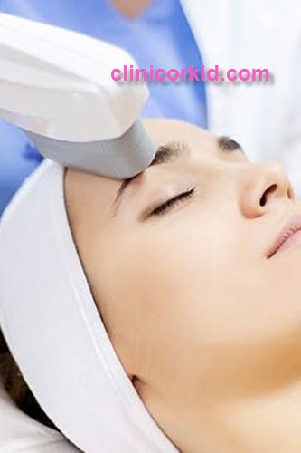 کلینیک لیزر موی صورت در غرب تهران - کلینیک ارکید