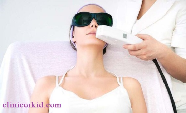 لیزر موهای صورت در غرب تهران کلینیک ارکید