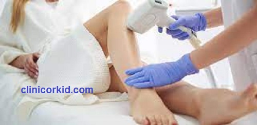 لیزر موهای زائد در پونک | کلینیک ارکید