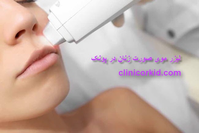 لیزر موی صورت زنان در پونک - کلینیک ارکید