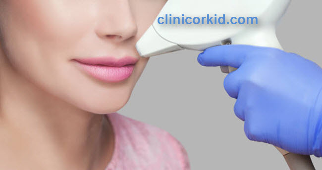 لیزر موی صورت زنان در پونک - کلینیک ارکید