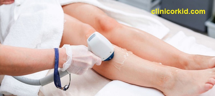 هزینه لیزر موهای زائد بدن - کلینیک ارکید