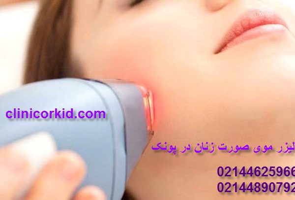لیزر موی صورت زنان در پونک کلینیک ارکید