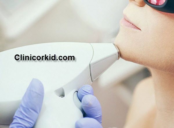 قیمت لیزر کردن موهای زائد - کلینیک ارکید