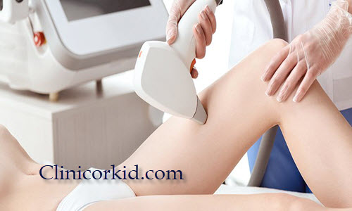 مراقبت های قبل و بعد لیزر موهای زائد - کلینیک ارکید