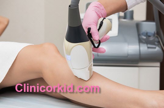 معتبرترین مرکز لیزر موی تهران - کلینیک ارکید