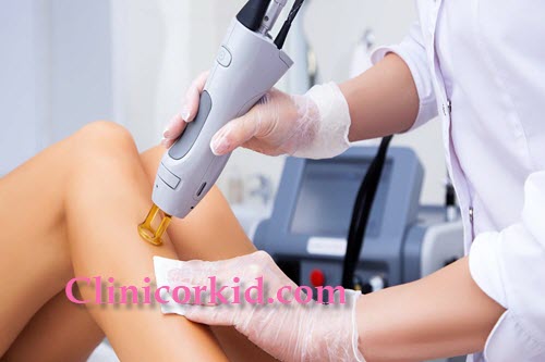 نکات بعد از لیزر موهای زائد - کلینیک ارکید