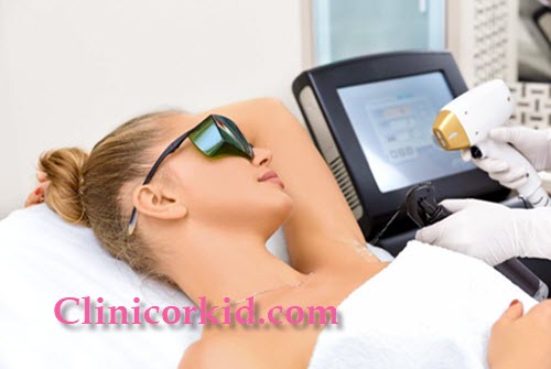 نکات بعد از لیزر موهای زائد - کلینیک ارکید