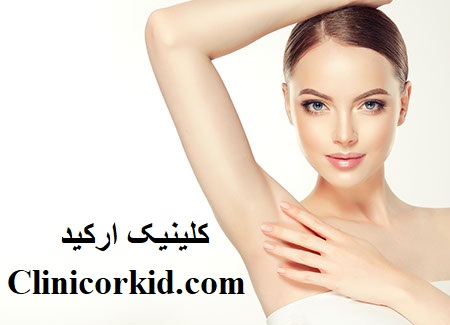 نکات بعد از لیزر موهای زائد کلینیک ارکید