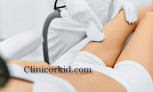 مراقبت های قبل و بعد لیزر موهای زائد کلینیک ارکید