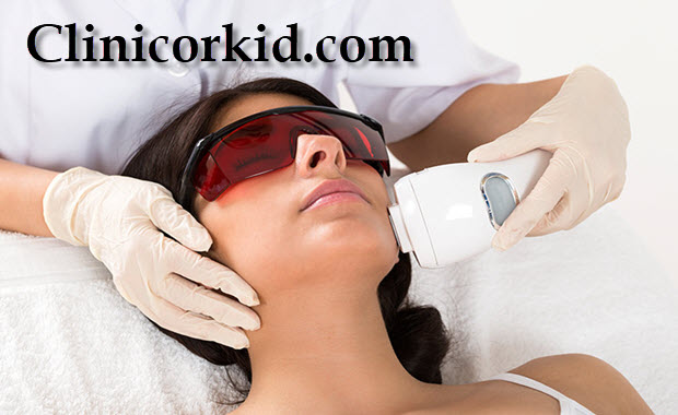 مزایای استفاده از لیزر برای موهای زائد کلینیک ارکید