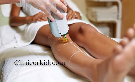 بهترین دستگاه لیزر برای پوست های تیره - کلینیک ارکید