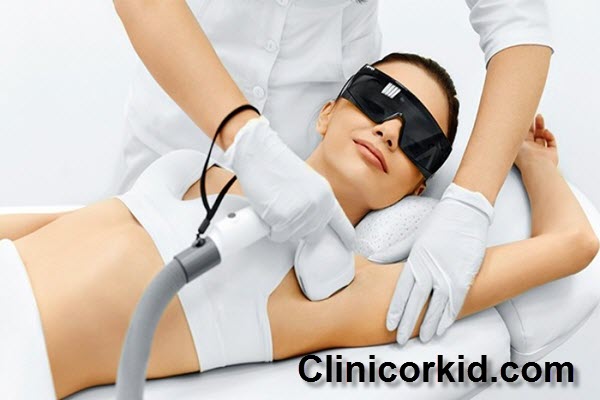 لیزر موهای زائد چه مدت طول میکشد؟ - کلینیک ارکید