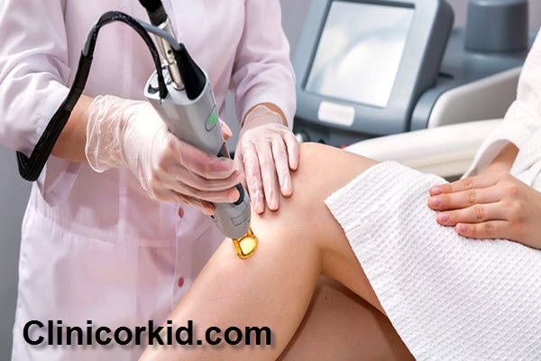 لیزر موهای زائد چه مدت طول میکشد؟ - کلینیک ارکید