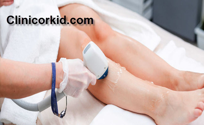 هزینه لیزر موهای زائد بانوان در غرب تهران - کلینیک ارکید