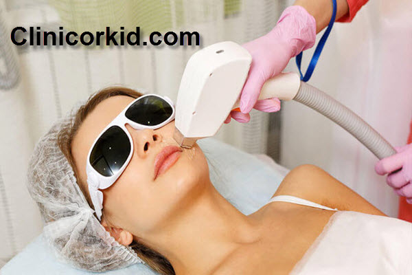 همه چیز درباره ی لیزر موهای زائد - کلینیک ارکید