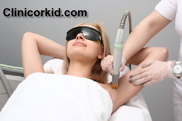 لیزر موهای زائد چه مدت طول میکشد؟ | کلینیک ارکید