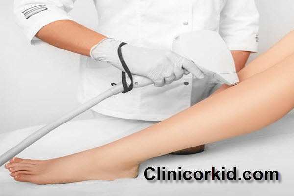 هزینه لیزر موهای زائد بانوان در غرب تهران کلینیک ارکید