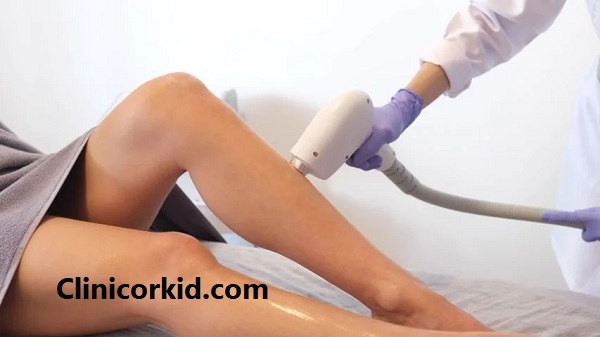 لیزر موهای زائد بدن چند جلسه است؟ - کلینیک ارکید