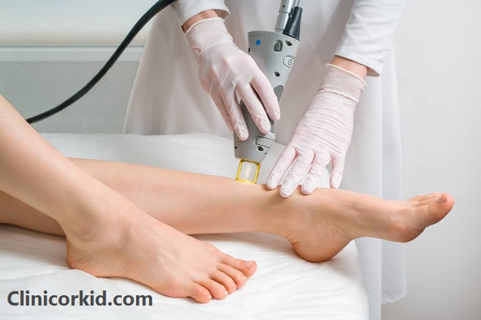 مرکز خوب برای لیزر موهای زائد در تهران - کلینیک ارکید