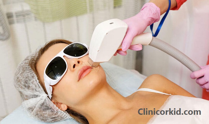 مرکز خوب برای لیزر موهای زائد در تهران - کلینیک ارکید