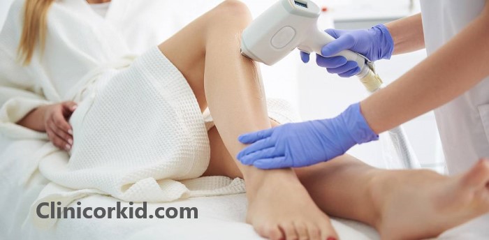 هزینه رفع موهای زائد با لیزر - کلینیک ارکید