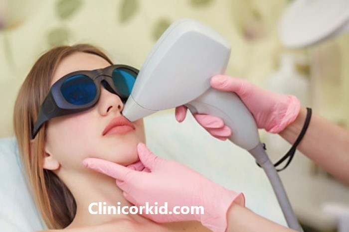 آیا لیزر موهای نازک را از بین میبرد؟ کلینیک ارکید