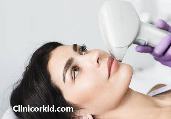 از بین بردن موهای زائد صورت با لیزر کلینیک ارکید