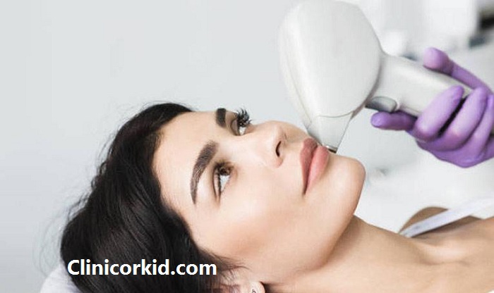 از بین بردن موهای زائد صورت با لیزر کلینیک ارکید