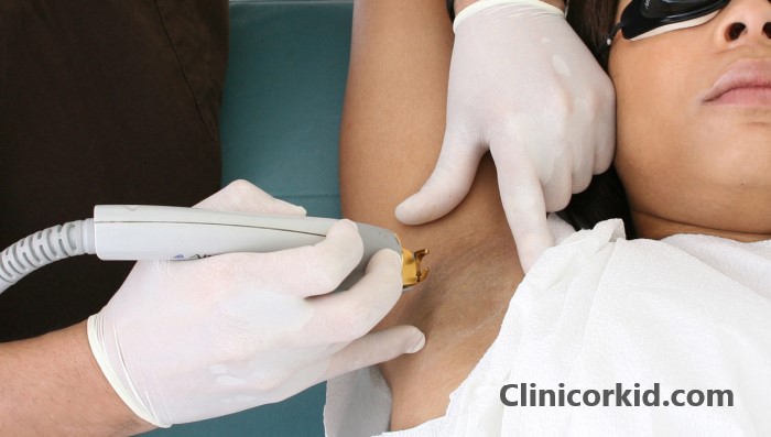 قیمت لیزر قسمت های مختلف بدن کلینیک ارکید