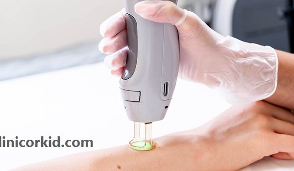 مرکز خوب برای لیزر موهای زائد در تهران کلینیک ارکید
