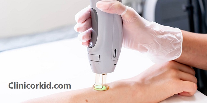 مرکز خوب برای لیزر موهای زائد در تهران کلینیک ارکید