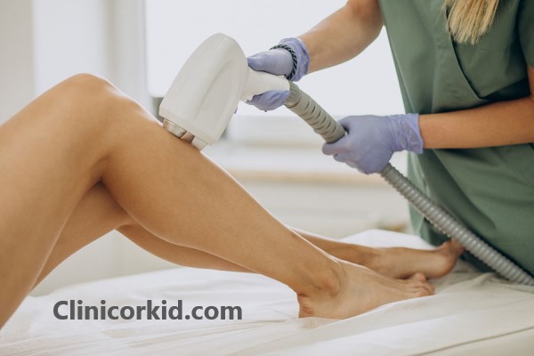 هزینه لیزر دائمی موهای بدن - کلینیک ارکید