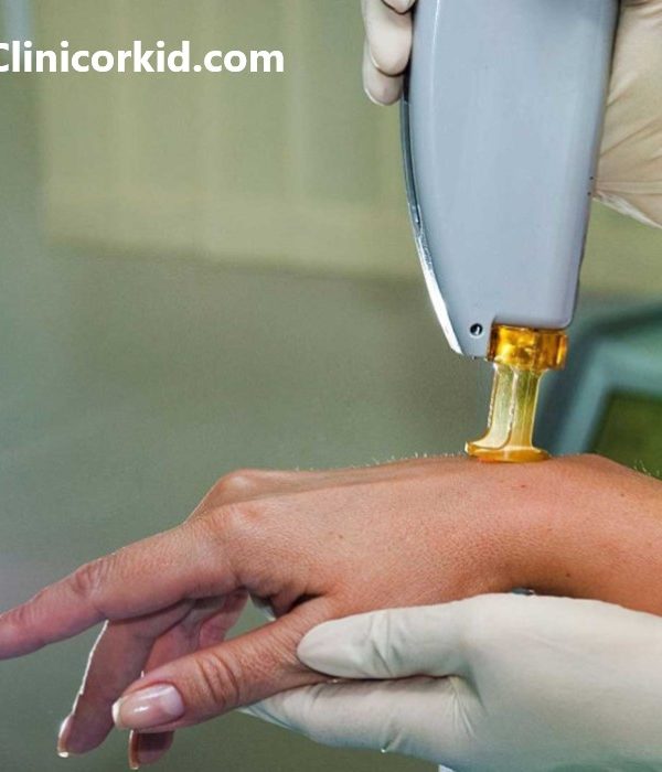مرکز لیزر موهای زائد قیمت مناسب در تهران کلینیک ارکید