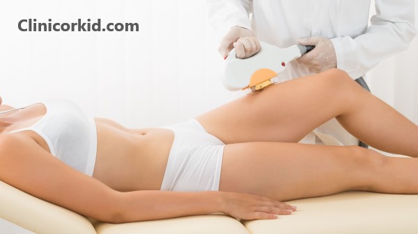 آیا لیزر موهای زائد دائمی است؟ - کلینیک ارکید