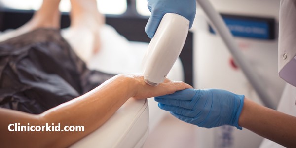 آیا لیزر موهای زائد دائمی است؟ - کلینیک ارکید