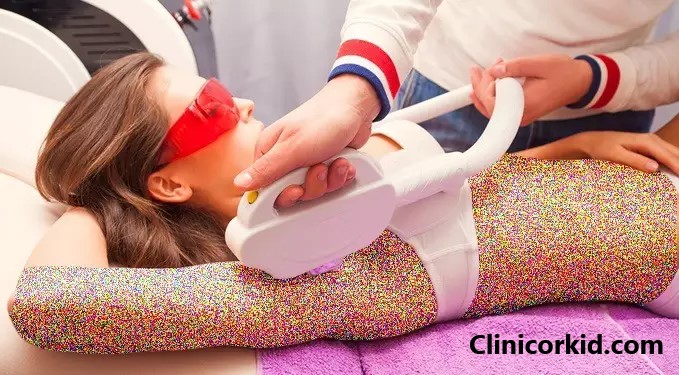 با چند جلسه لیزر موهای زائد از بین می رود؟ - کلینیک ارکید