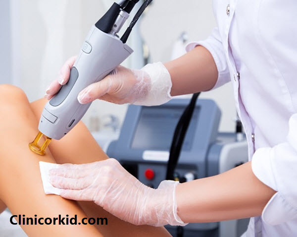 با چند جلسه لیزر موهای زائد از بین می رود؟ - کلینیک ارکید