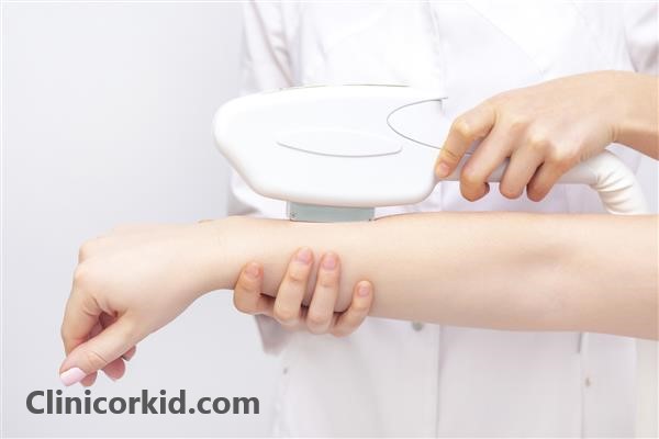 دلایل تیرگی پوست بعد از لیزر موهای زائد - کلینیک ارکید