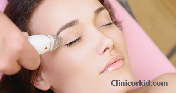 شستن صورت بعد از لیزر موهای زائد - کلینیک ارکید