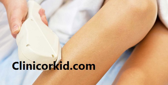 فرق دستگاه لیزر دایود و الکساندرایت در چیست؟ - کلینیک ارکید