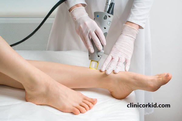 نکات قابل توجه در لیزر موهای زائد - کلینیک ارکید