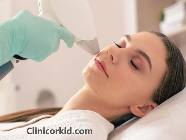 دلایل تیرگی پوست بعد از لیزر موهای زائد کلینیک ارکید