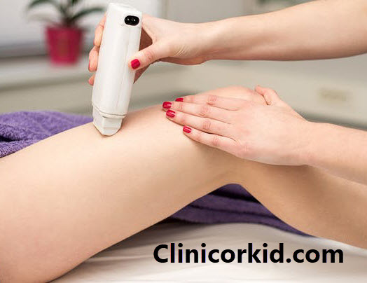 شایع ترین علت زیاد شدن مو بعد از لیزر چیست؟ کلینیک ارکید