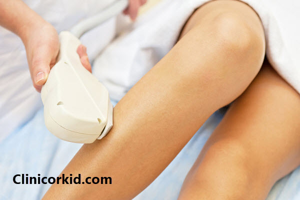 لیزر موهای زائد برای چه کسانی ضرر دارد؟ کلینیک ارکید